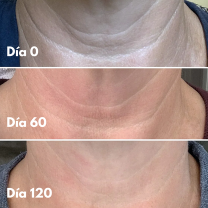 Crema reafirmante 4 en 1 - Cuello y papada reafirmado este Verano