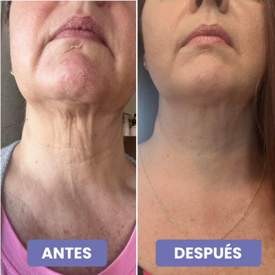 Crema reafirmante 4 en 1 - Cuello y papada reafirmado este Verano